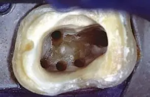 Hősök Tere Fogászat - Fogászati centrum mikroszkópos gyökérkezelés hs-dental.hu