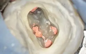 Hősök Tere Fogászat - Fogászati centrum mikroszkópos gyökérkezelés hs-dental.hu