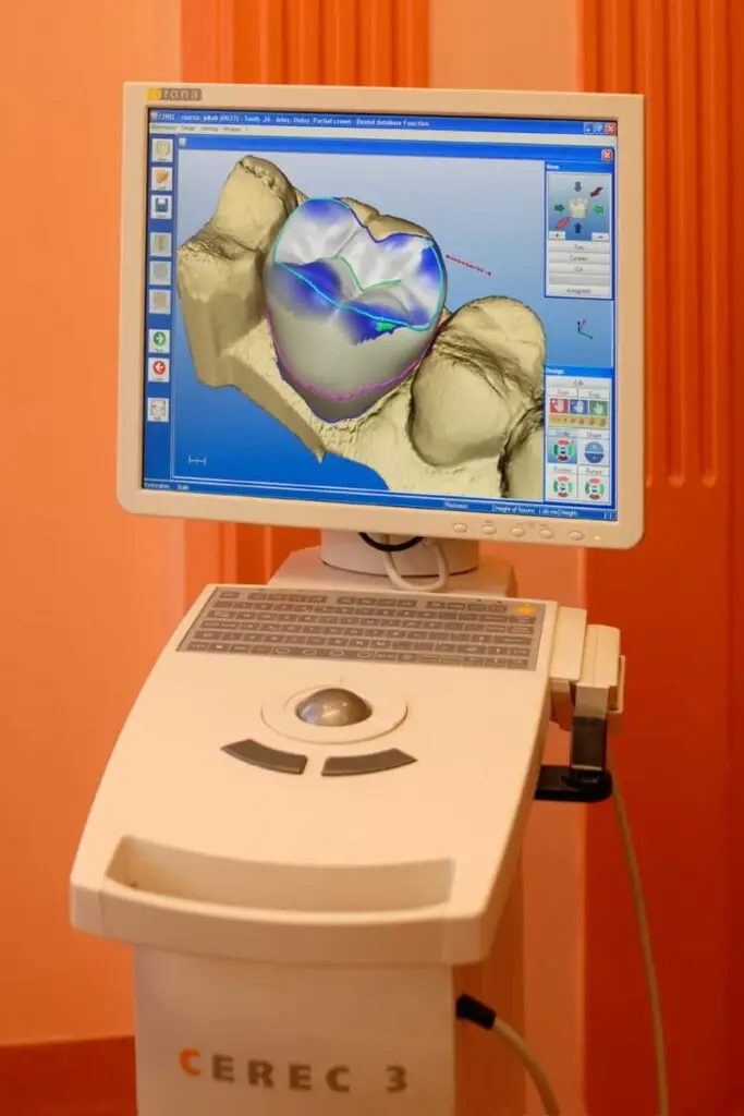 hs-dental-hosok-tere-fogaszat-digitalis-fogaszati-centrum-fogorvosi-rendelo-budapest-dental-cerec-cad-cam-digitalis-fogaszat