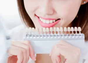 Fogfehérítés lépései